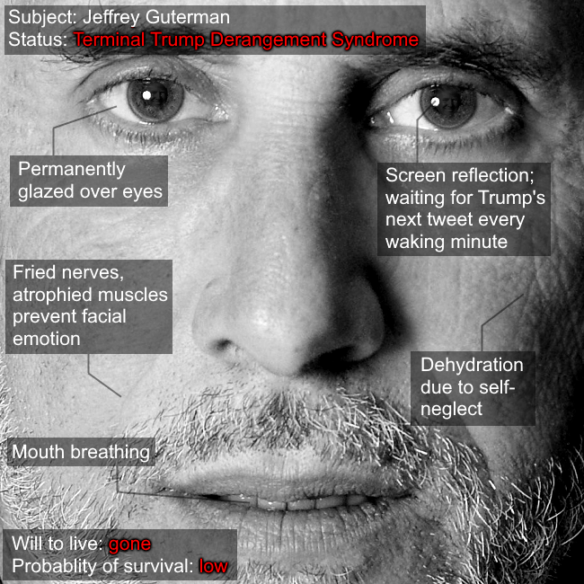 tds derangement syndrome